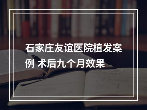 石家庄友谊医院植发案例 术后九个月效果