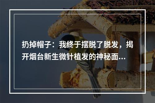 扔掉帽子：我终于摆脱了脱发，揭开烟台新生微针植发的神秘面纱！