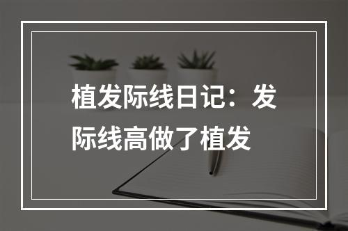 植发际线日记：发际线高做了植发