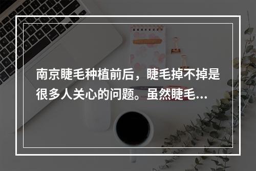 南京睫毛种植前后，睫毛掉不掉是很多人关心的问题。虽然睫毛种植技术不断进步，但仍然存在睫毛掉落的现象，下面我们就来了解一下。