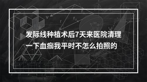 发际线种植术后7天来医院清理一下血痂我平时不怎么拍照的