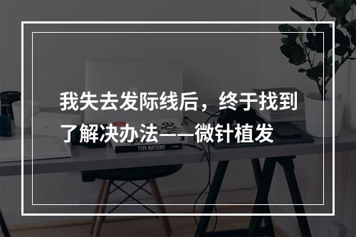 我失去发际线后，终于找到了解决办法——微针植发