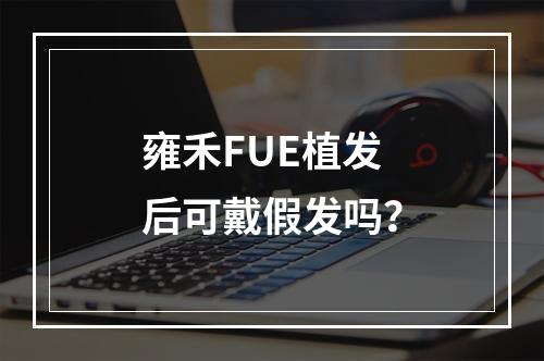 雍禾FUE植发后可戴假发吗？