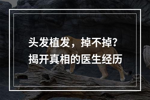 头发植发，掉不掉？揭开真相的医生经历