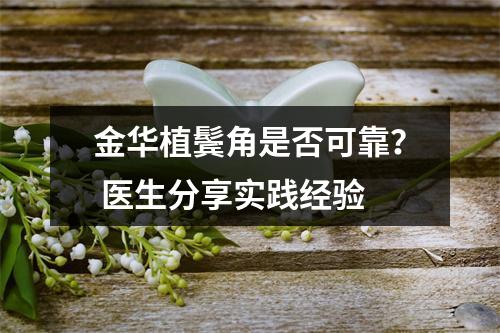 金华植鬓角是否可靠？ 医生分享实践经验