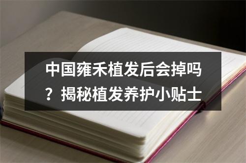 中国雍禾植发后会掉吗？揭秘植发养护小贴士