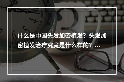 什么是中国头发加密植发？头发加密植发治疗究竟是什么样的？不妨让我们一起来了解一下。