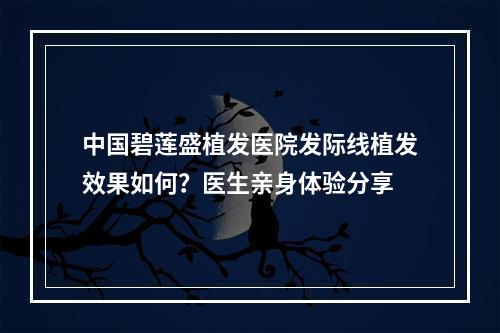 中国碧莲盛植发医院发际线植发效果如何？医生亲身体验分享