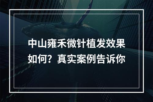 中山雍禾微针植发效果如何？真实案例告诉你