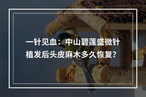 一针见血：中山碧莲盛微针植发后头皮麻木多久恢复？