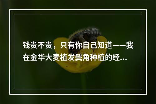 钱贵不贵，只有你自己知道——我在金华大麦植发鬓角种植的经历