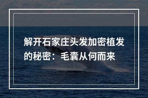 解开石家庄头发加密植发的秘密：毛囊从何而来