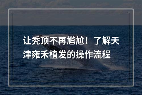 让秃顶不再尴尬！了解天津雍禾植发的操作流程