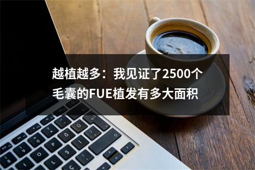 越植越多：我见证了2500个毛囊的FUE植发有多大面积