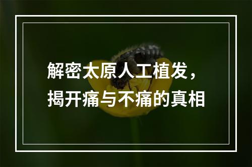 解密太原人工植发，揭开痛与不痛的真相