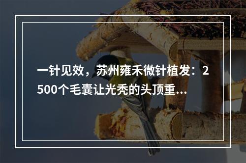 一针见效，苏州雍禾微针植发：2500个毛囊让光秃的头顶重现生机