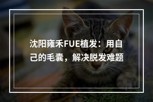 沈阳雍禾FUE植发：用自己的毛囊，解决脱发难题