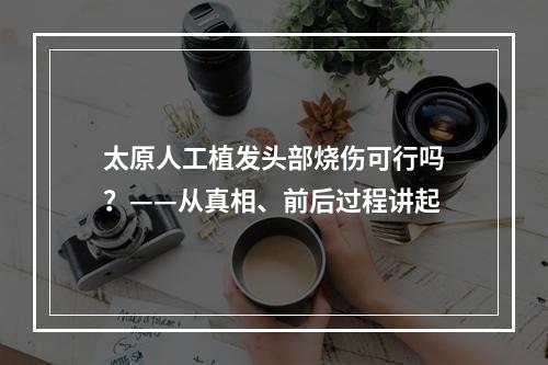 太原人工植发头部烧伤可行吗？——从真相、前后过程讲起