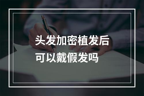 头发加密植发后可以戴假发吗