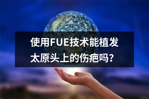 使用FUE技术能植发太原头上的伤疤吗？