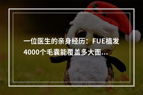 一位医生的亲身经历：FUE植发4000个毛囊能覆盖多大面积？