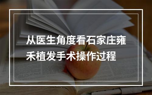 从医生角度看石家庄雍禾植发手术操作过程