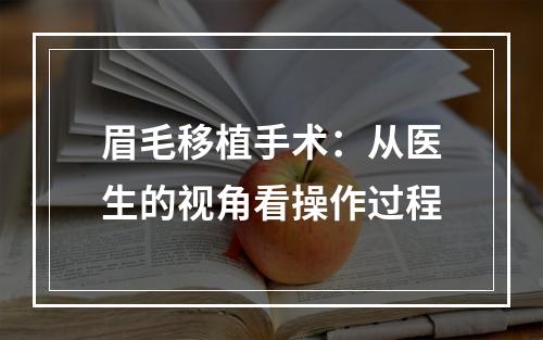 眉毛移植手术：从医生的视角看操作过程