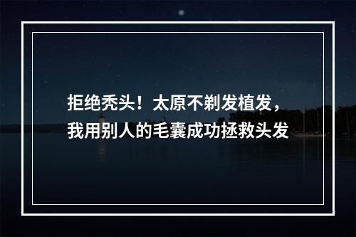 拒绝秃头！太原不剃发植发，我用别人的毛囊成功拯救头发