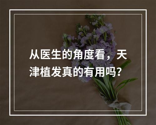 从医生的角度看，天津植发真的有用吗？