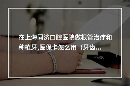 在上海同济口腔医院做根管治疗和种植牙,医保卡怎么用（牙齿根管治疗要多久?）