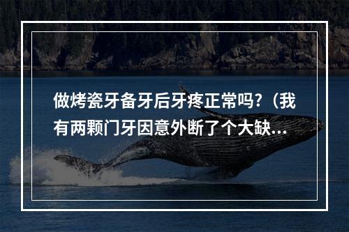 做烤瓷牙备牙后牙疼正常吗?（我有两颗门牙因意外断了个大缺口,牙医说要做烤瓷牙,磨牙后带牙套。大家...）