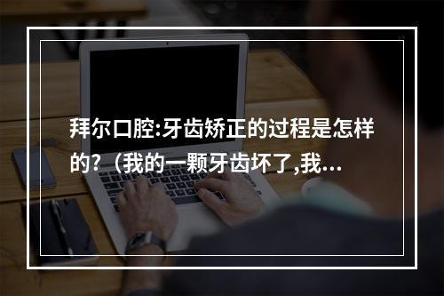 拜尔口腔:牙齿矫正的过程是怎样的?（我的一颗牙齿坏了,我想做种植牙,听说种植牙天价,太贵了,除了种植牙,还 ...）