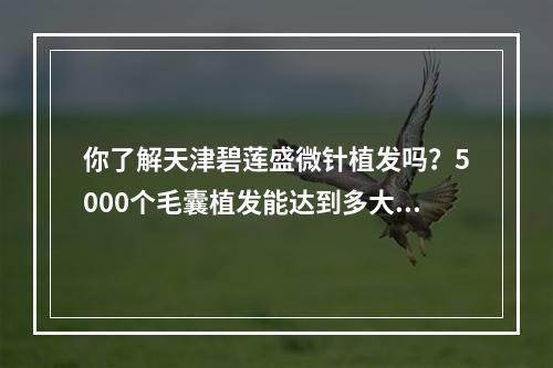 你了解天津碧莲盛微针植发吗？5000个毛囊植发能达到多大面积？