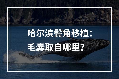 哈尔滨鬓角移植：毛囊取自哪里？