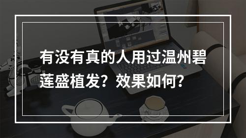 有没有真的人用过温州碧莲盛植发？效果如何？