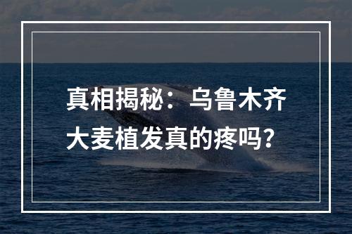 真相揭秘：乌鲁木齐大麦植发真的疼吗？