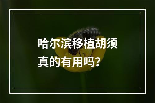 哈尔滨移植胡须真的有用吗？