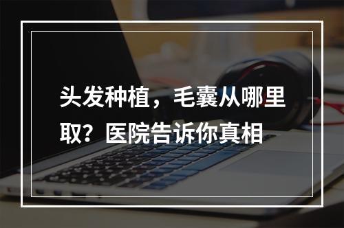 头发种植，毛囊从哪里取？医院告诉你真相