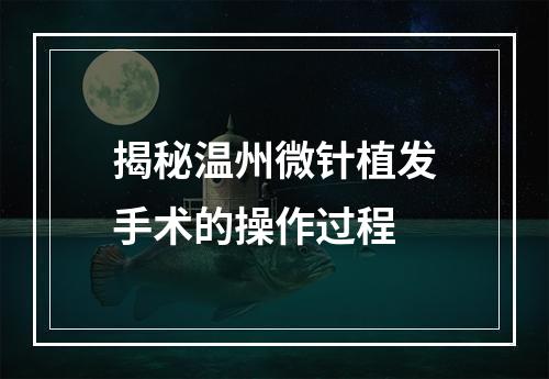 揭秘温州微针植发手术的操作过程