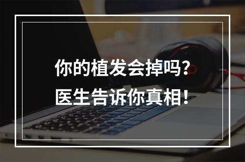 你的植发会掉吗？医生告诉你真相！