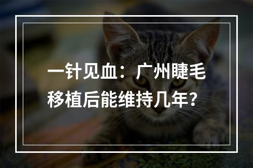 一针见血：广州睫毛移植后能维持几年？