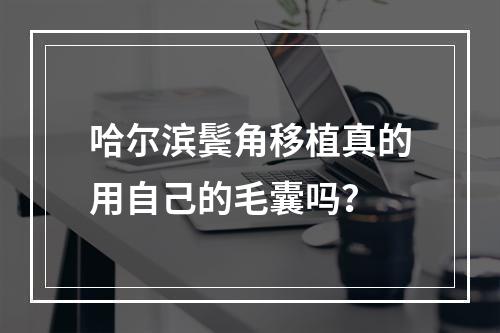 哈尔滨鬓角移植真的用自己的毛囊吗？