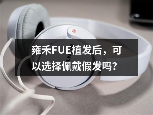 雍禾FUE植发后，可以选择佩戴假发吗？