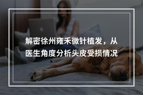 解密徐州雍禾微针植发，从医生角度分析头皮受损情况