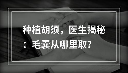 种植胡须，医生揭秘：毛囊从哪里取？