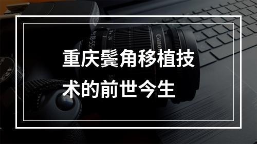 重庆鬓角移植技术的前世今生