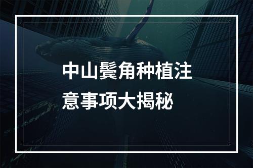 中山鬓角种植注意事项大揭秘