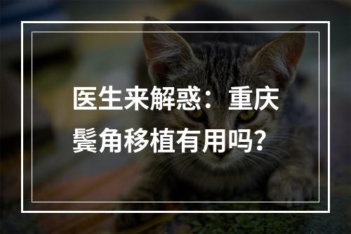 医生来解惑：重庆鬓角移植有用吗？