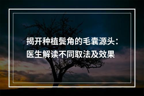 揭开种植鬓角的毛囊源头：医生解读不同取法及效果