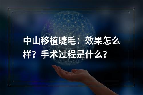 中山移植睫毛：效果怎么样？手术过程是什么？